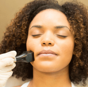 radio frequency skin tightening