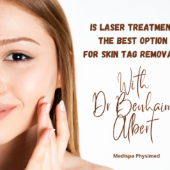 Is Laser Treatment the Best Option for Skin Tag Removal and Does it Leave a Scar?